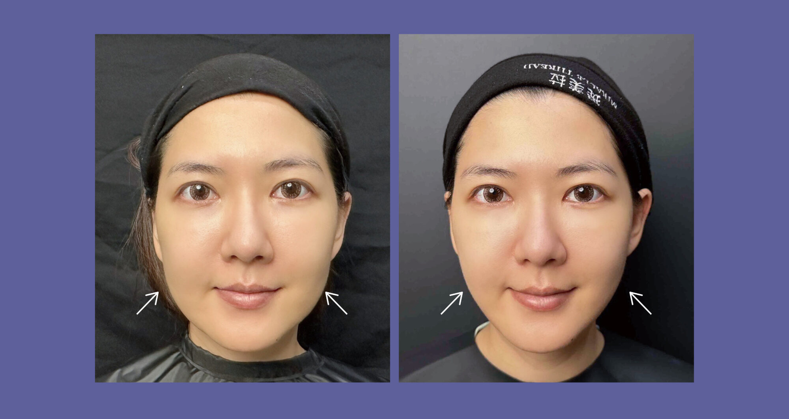 一張含有 人的臉孔, 人員, 眉毛, 微笑 的圖片 AI 產生的內容可能不正確。
