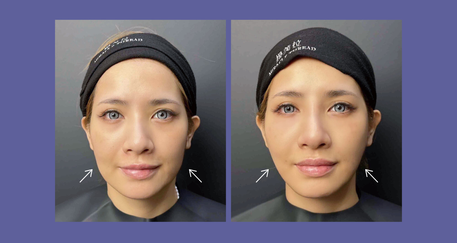 一張含有 人的臉孔, 人員, 服裝, 眉毛 的圖片 AI 產生的內容可能不正確。
